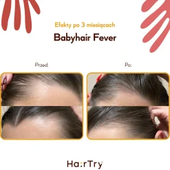 HairTry - Babyhair Fever - Wcierka Rozgrzewająca na Porost Włosów - 200ml