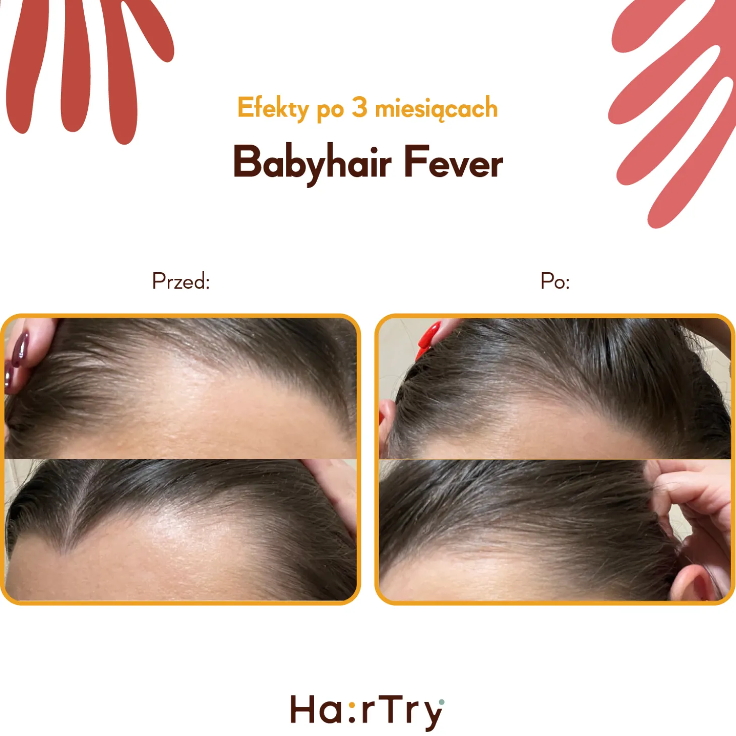 HairTry - Babyhair Fever - Wcierka Rozgrzewająca na Porost Włosów - 100ml