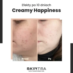 SkinTra - Creamy Happiness - Emulsja z Retinalem 0,1% w Cyklodekstrynach - 30ml