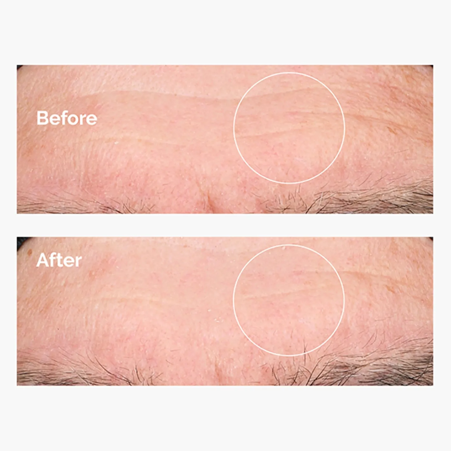 The Ordinary - Hyaluronic Acid 2% + B5 - Serum Nawilżające z Kwasem Hialuronowym 2% i Witaminą B5 - 30ml