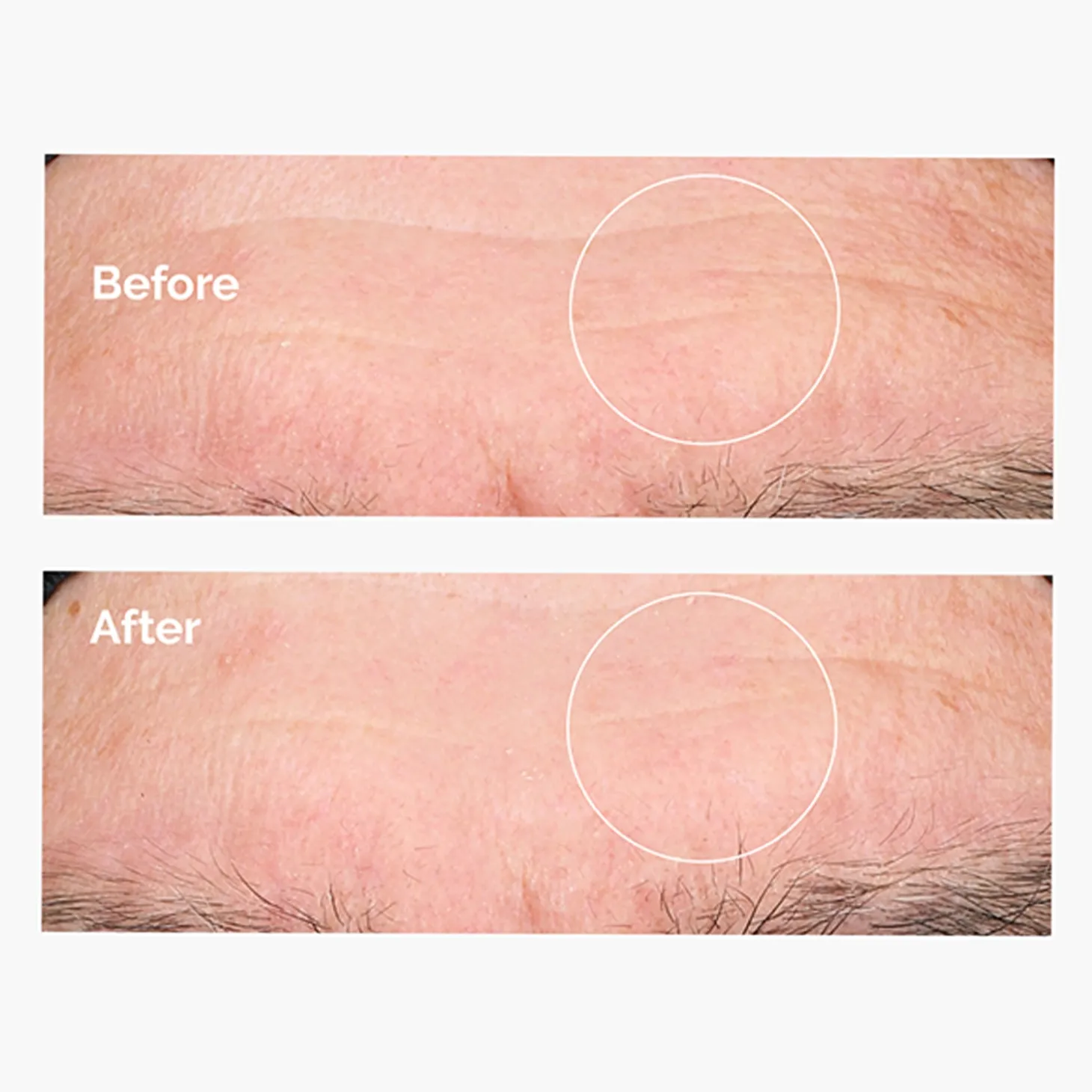 The Ordinary - Hyaluronic Acid 2% + B5 - Serum Nawilżające z Kwasem Hialuronowym 2% i Witaminą B5 - 60ml