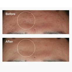 The Ordinary - Niacinamide 10% + Zinc 1% - Serum z Witaminą B3 i Cynkiem - 30ml